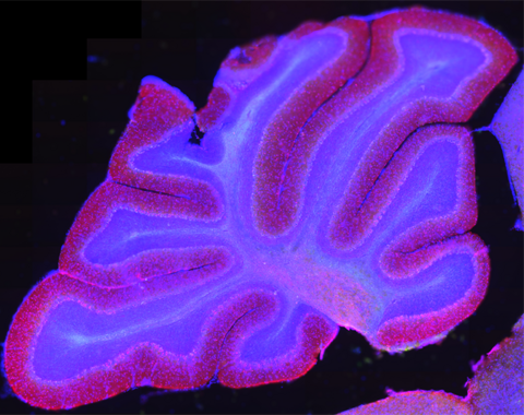 cerebellum1.png Cerebellum