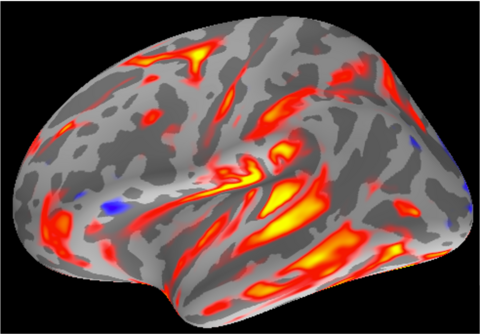 EEG image of a brain