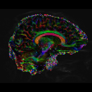 twice-exceptional-image