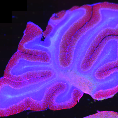 cerebellum