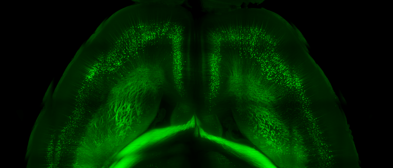 brain-lightsheet-scope