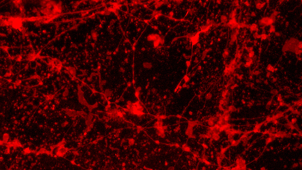 Neuronal beading