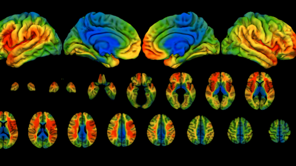 Neurological Patient Registry